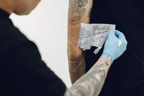 Usuwanie tatuażu a ból – czy usuwanie tatuażu boli?